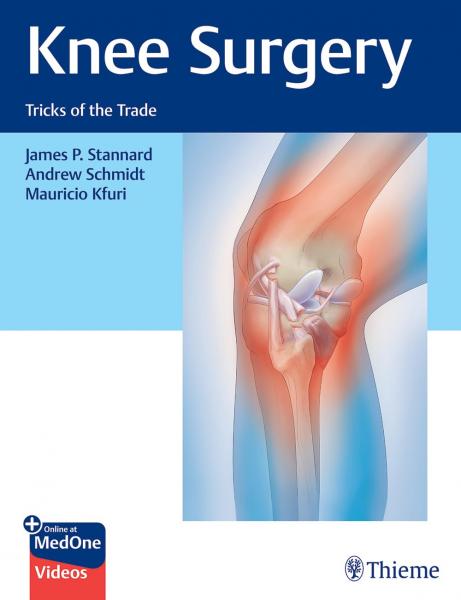  Knee Surgery: Tricks of the Trade 1st edition 2022 - جراحی